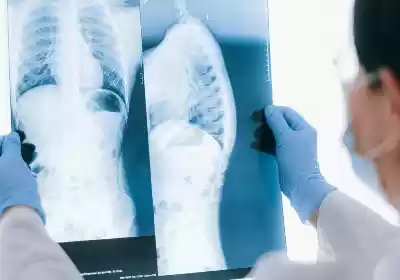 ﻿AI is just as top as a physician at reading chest X-rays